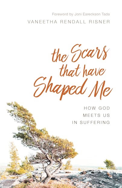 The Scars That Have Shaped Me: How God Meets Us in Suffering